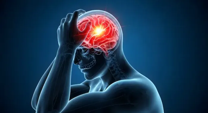 What Really Triggers a Migraine Attack The Chain Reaction Explained